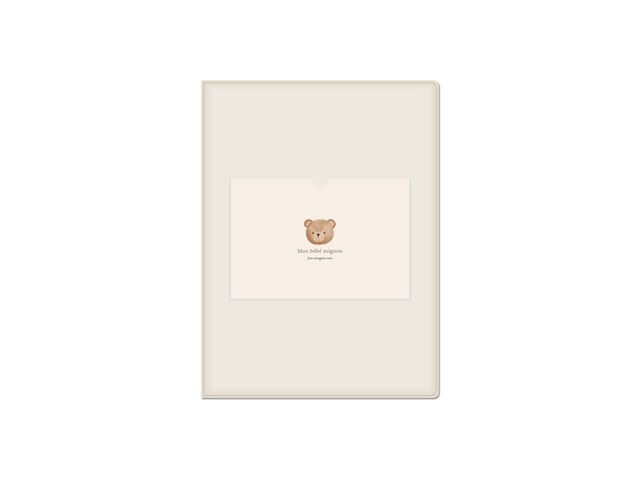 초음파사진 구매 필수 가이드 & 추천 리스트